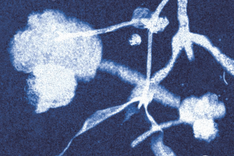 Nieuw boek 'Het ongemak van een lichaam' door oud-WOLKER Corinne Heyrman en Jante Wortel